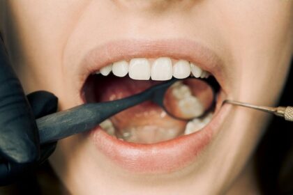 How To Qualify For Government Grants For Dental Care
